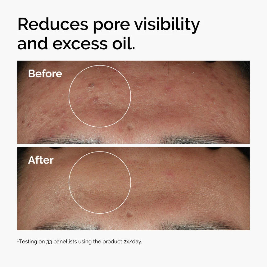 The Ordinary Niacinamide 10% + Zinc 1% Serum 30ml 100% Authentic