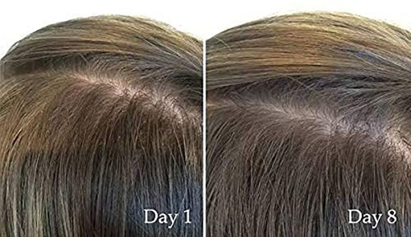 The Ordinary Multi-Peptide Hair Serum For Hair Density . 60 mL . Latest Version . 100% Authentic