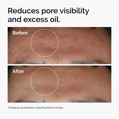The Ordinary Niacinamide 10% + Zinc 1% Serum 30ml 100% Authentic